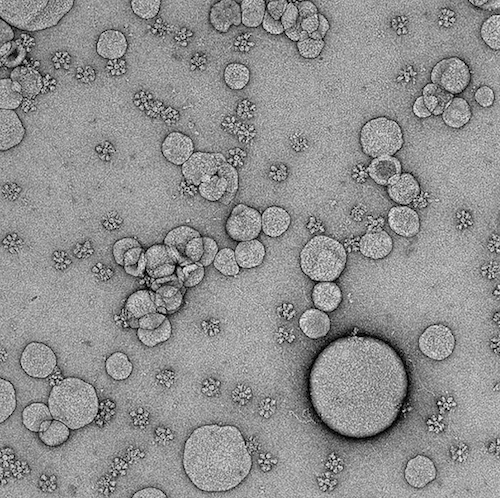 Electron microscope image of SpFN vaccine